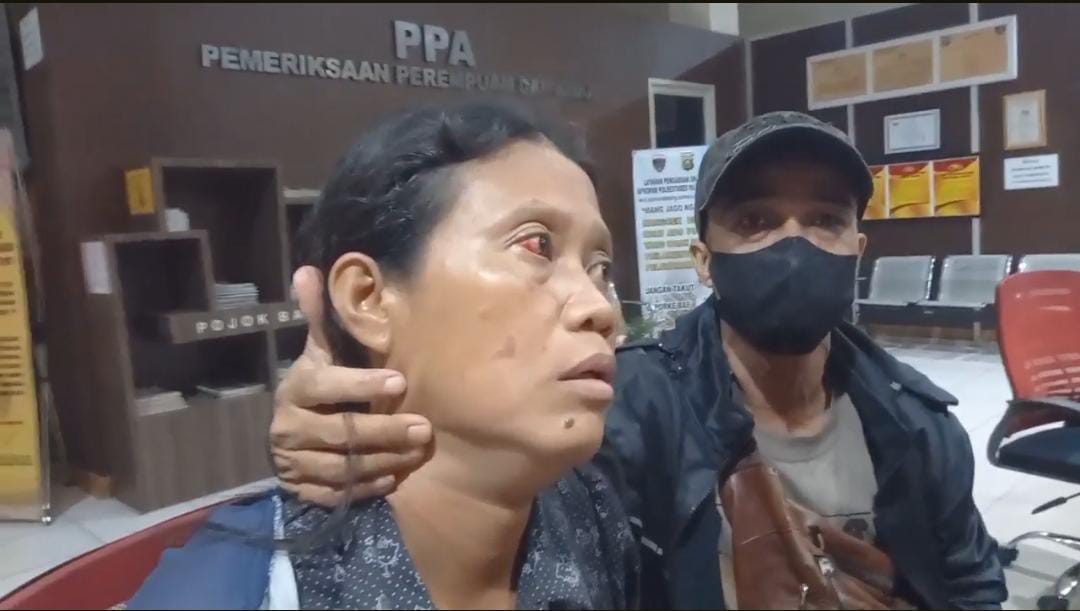 Hendak Beli Sarapan, IRT di Palembang Babak Belur Dipukuli Tetangga