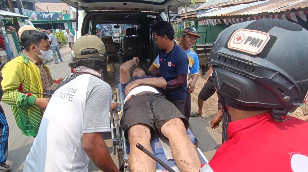 Korban Kebakaran di Saudagar Yucing Palembang, Alami Luka Bakar di Tangan dan Kaki Dilarikan ke RS