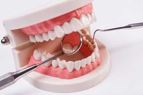 Dampak Pengroposan gigi pada pemakai sabu (metafitamin)