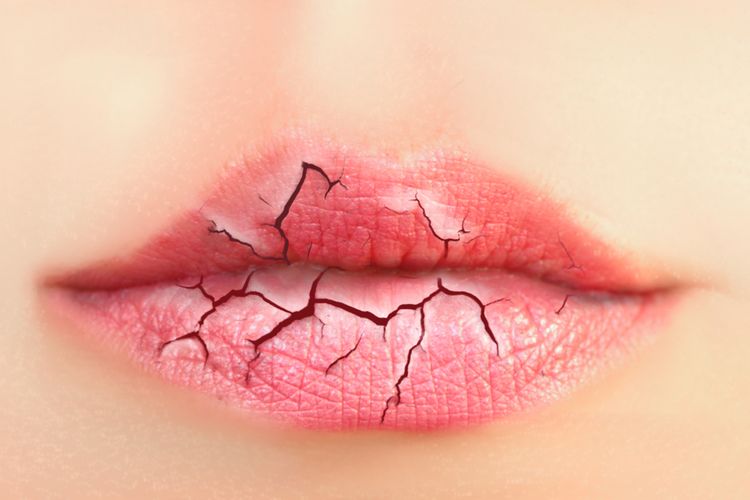 Perlu Tahu, Ternyata Ini Penyebab dan Cara Mengatasi Bibir Pecah-Pecah hingga Tuntas