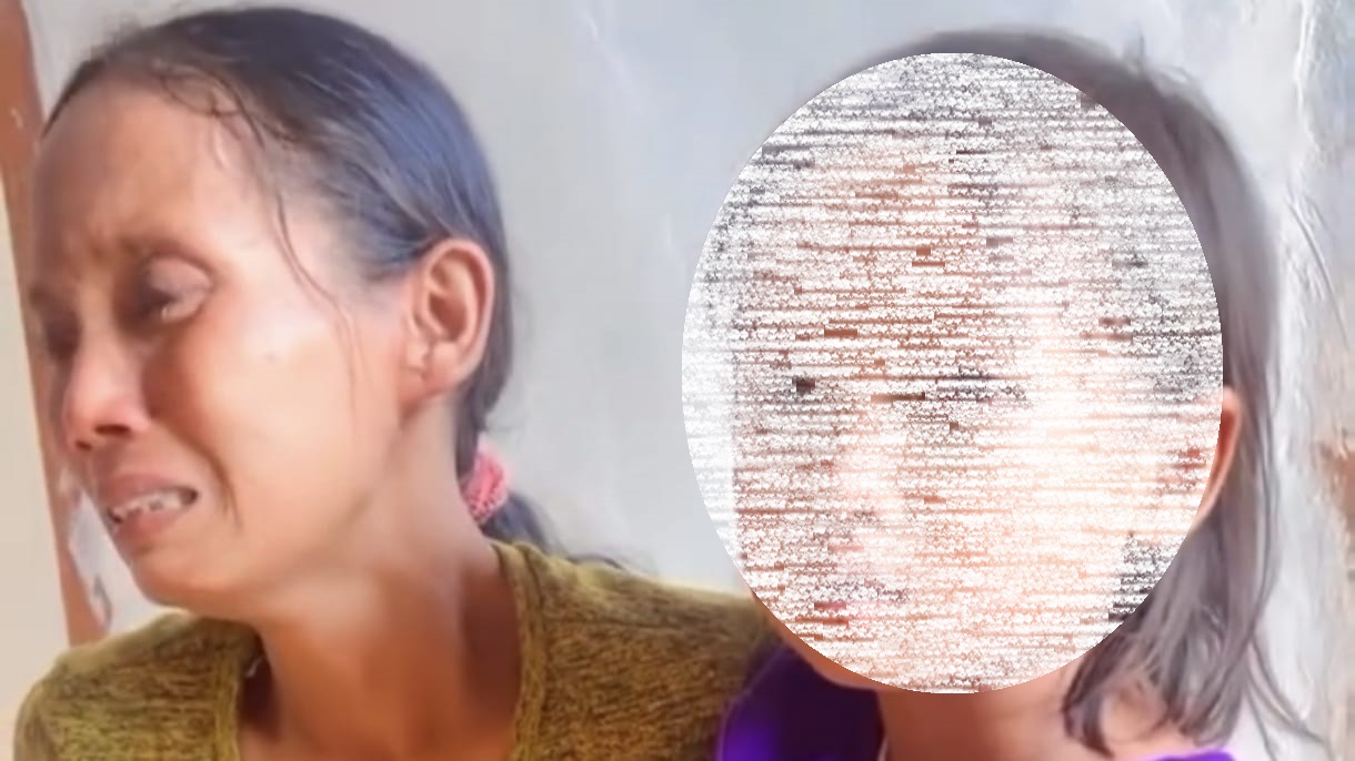 Mata Siswi SD di Palembang Merah Diduga Dianiaya Guru, Sekolah Bantah Terjadi Kekerasan