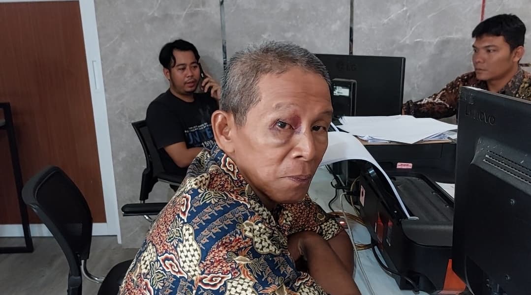 Lapor Polisi, Penjaga Parkir di Acara Duka Dianiaya dan Ditinju Matanya oleh Seorang Wanita