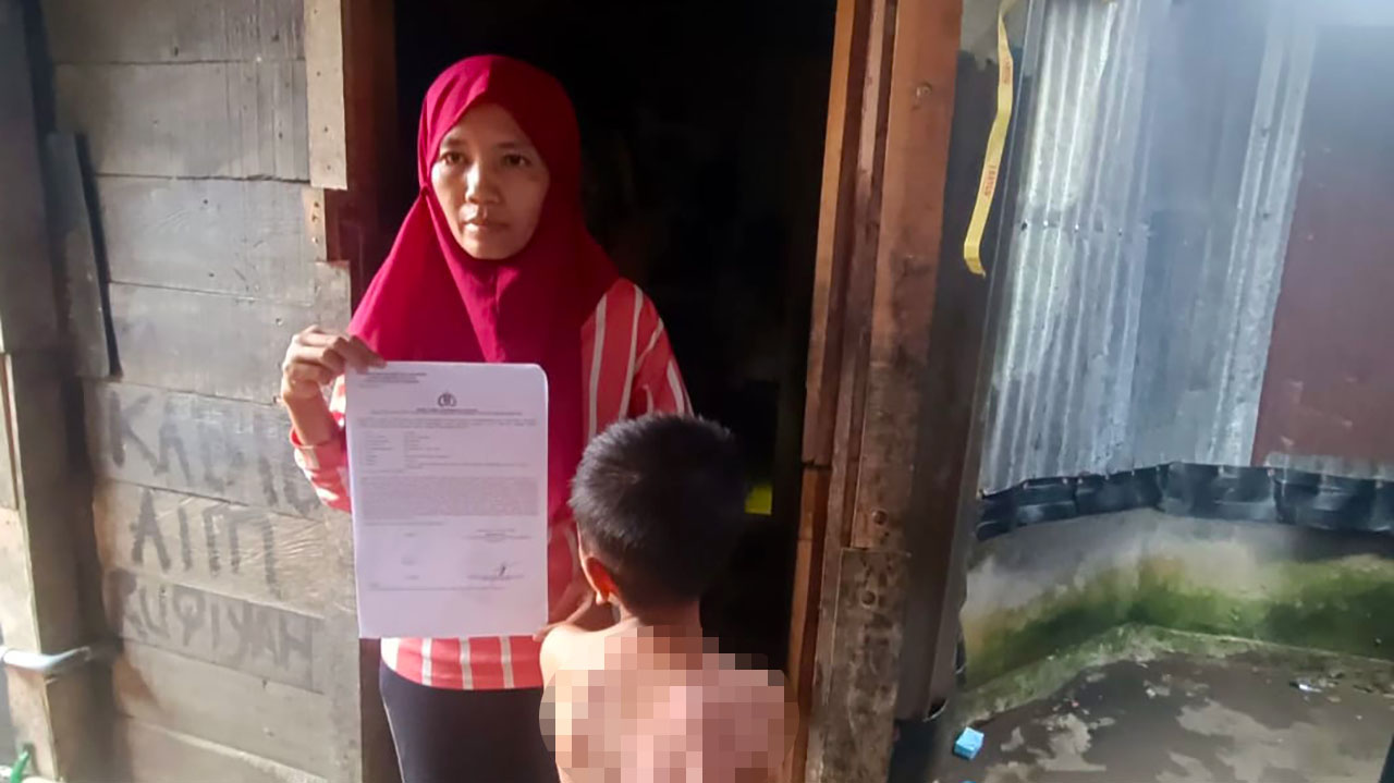 Anak Disiram Air Panas Hingga Melepuh, Seorang Ibu di Palembang Berharap Keadilan