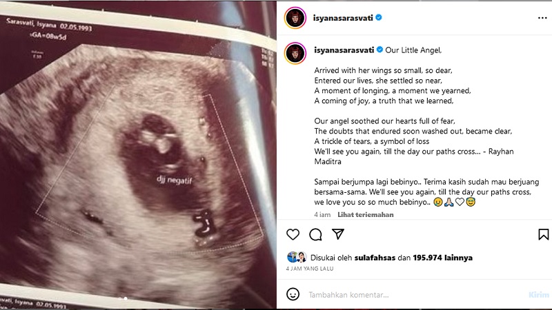 Isyana Sarasvati Posting Hasil USG Yang Menyatakan Bayinya Meninggal! Kabarkan Lewat Unggahan Instagram