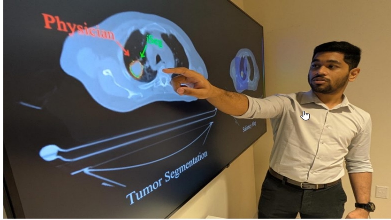 AI Deteksi Tumor Paru-Paru Tersembunyi yang Terlewat oleh Dokter dan Sangat Cepat