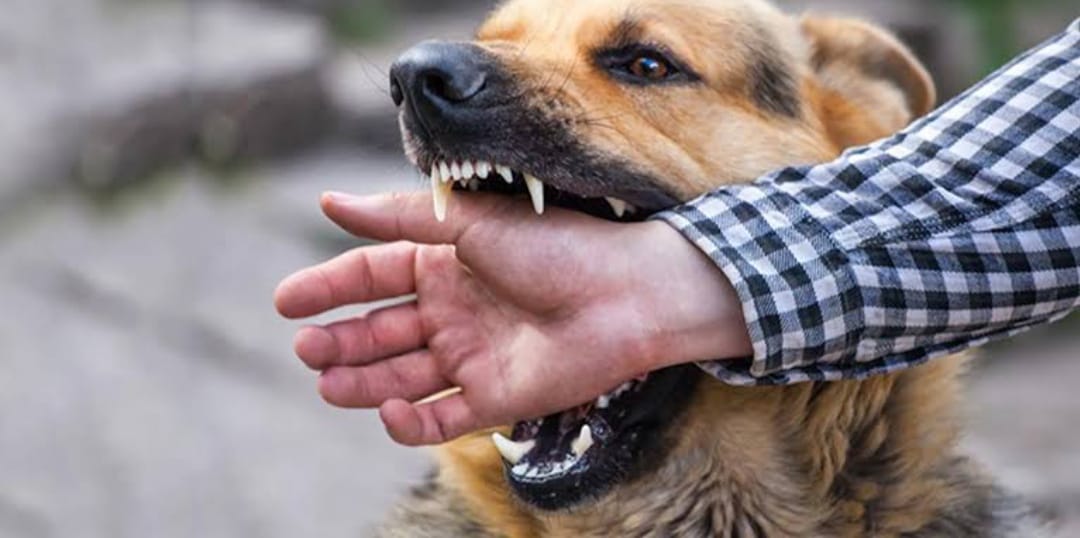 Jangan Sepelehkan Gigitan Anjing yang Terkena Rabies, Ini Bahayanya