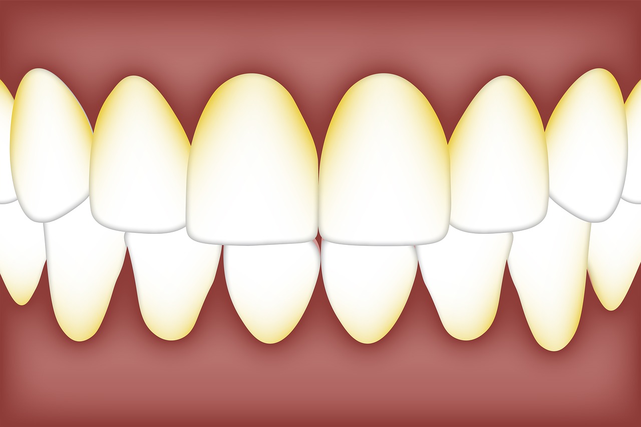Cara Sederhana Menghilangkan Karang Gigi di Rumah Bikin Senyuman Makin Memukau!