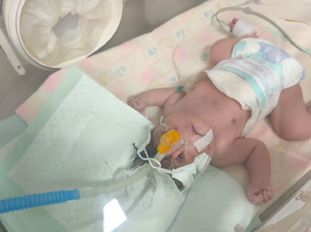Tangis Haru di NICU: Bayi Tanpa Tempurung Kepala Lahir, Sang Ayah Harap Uluran Tangan Dermawan