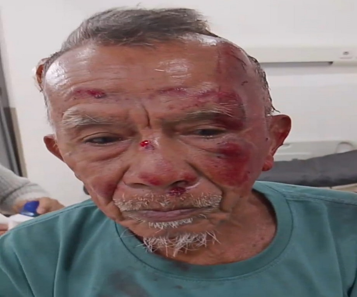 Kakek 75 Tahun Jadi Korban Begal di Palembang, Handphone Dirampas dan Kepala Alami Luka Serius