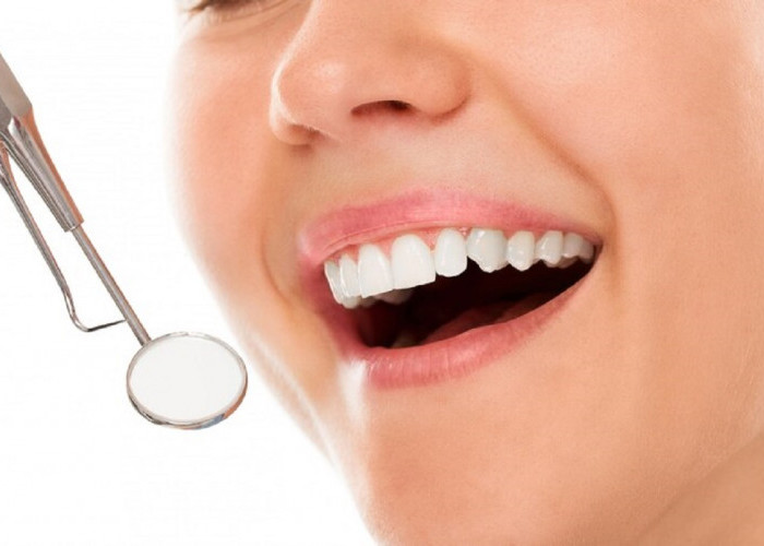 Perlukah Scaling Gigi Setiap 6 Bulan dan Kenapa Karang Gigi Harus Dibersihkan?