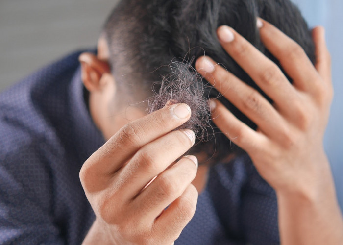 Rambut Rontok Sering Dialami Setiap Orang dan Bikin Sebel, Inilah 5 Cara Menghindarinya