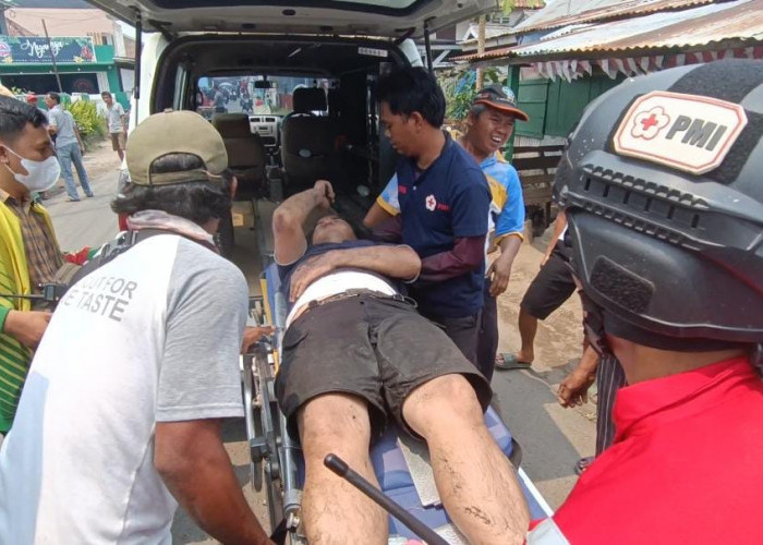 Korban Kebakaran di Saudagar Yucing Palembang, Alami Luka Bakar di Tangan dan Kaki Dilarikan ke RS