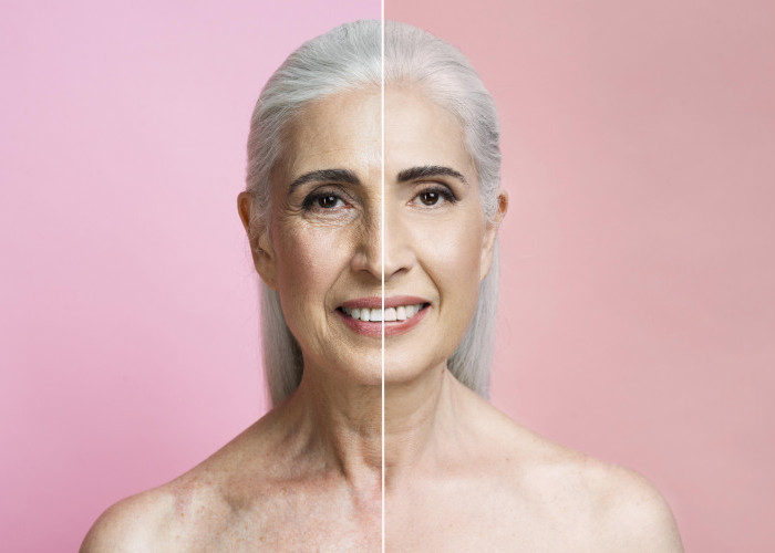 Ahli Bedah Plastik yang Terkenal di TikTok Ungkap Alasan  Proses Penuaan Wajah