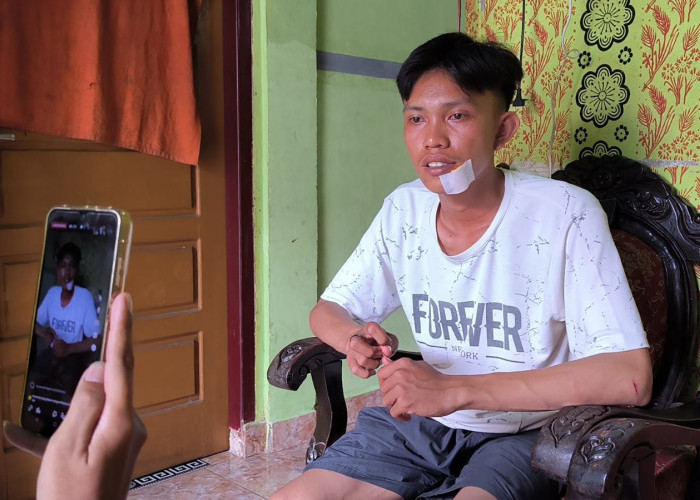 Melawan Begal Demi Selamatkan Motor, Pemuda Palembang Luka Parah