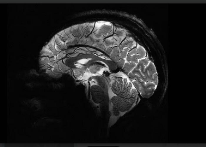 Mesin MRI Paling Canggih Di Dunia Mampu Pemindaian Otak Pertama Secara Detail