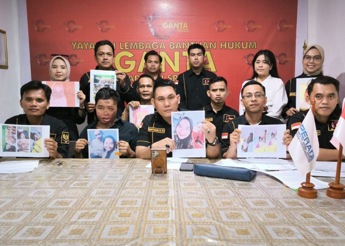 Tangis SY: Disiram Air Keras, Suami Masih Bebas
