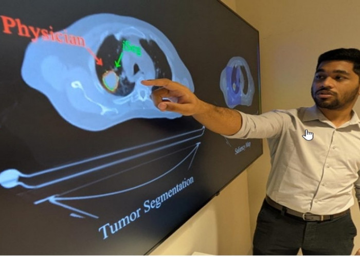 AI Deteksi Tumor Paru-Paru Tersembunyi yang Terlewat oleh Dokter  dan Sangat Cepat