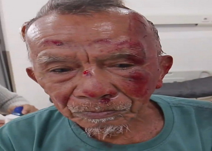 Kakek 75 Tahun Jadi Korban Begal di Palembang, Handphone Dirampas dan Kepala Alami Luka Serius