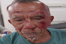 Kakek 75 Tahun Jadi Korban Begal di Palembang, Handphone Dirampas dan Kepala Alami Luka Serius